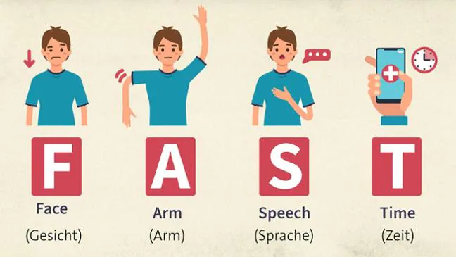 Auf der Grafik wird die F-A-S-T-Methode dargestellt. F steht für Face (Gesicht). A steht für Arm (Arm). S steht für Speech (Sprache). T steht für Time (Zeit). Unterstützt wird es jeweils mit einer Grafik dazu. 